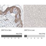 ZNF710 Antibody in Immunohistochemistry (IHC)