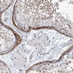 LIN9 Antibody in Immunohistochemistry (IHC)