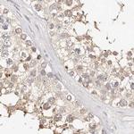 KCMF1 Antibody in Immunohistochemistry (IHC)