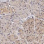 KCMF1 Antibody in Immunohistochemistry (IHC)