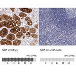 GDA Antibody in Immunohistochemistry (IHC)