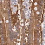 GDA Antibody in Immunohistochemistry (IHC)