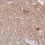 GDA Antibody in Immunohistochemistry (IHC)