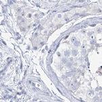 TXLNB Antibody in Immunohistochemistry (IHC)