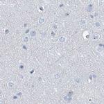 TXLNB Antibody in Immunohistochemistry (IHC)