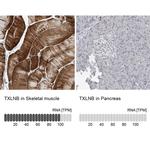 TXLNB Antibody in Immunohistochemistry (IHC)