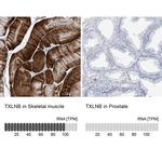 TXLNB Antibody in Immunohistochemistry (IHC)