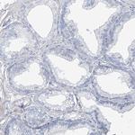 TXLNB Antibody in Immunohistochemistry (IHC)