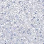 TXLNB Antibody in Immunohistochemistry (IHC)