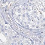 TXLNB Antibody in Immunohistochemistry (IHC)