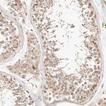 KIF9 Antibody in Immunohistochemistry (IHC)