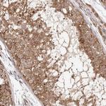 MICAL2 Antibody in Immunohistochemistry (IHC)