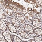 MICAL2 Antibody in Immunohistochemistry (IHC)