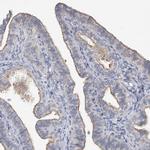 PARD3 Antibody in Immunohistochemistry (IHC)