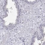 MAGEB4 Antibody in Immunohistochemistry (IHC)