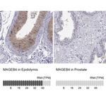 MAGEB4 Antibody