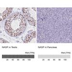 NASP Antibody in Immunohistochemistry (IHC)