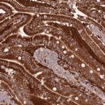 LPIN2 Antibody in Immunohistochemistry (IHC)