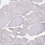 LPIN2 Antibody in Immunohistochemistry (IHC)