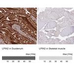 LPIN2 Antibody