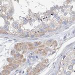 UFL1 Antibody in Immunohistochemistry (IHC)