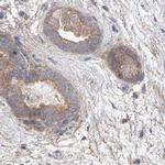 UFL1 Antibody in Immunohistochemistry (IHC)