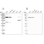 UFL1 Antibody in Western Blot (WB)