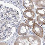 UFL1 Antibody in Immunohistochemistry (IHC)