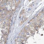 UFL1 Antibody in Immunohistochemistry (IHC)