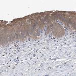 UFL1 Antibody in Immunohistochemistry (IHC)