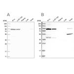 UFL1 Antibody in Western Blot (WB)