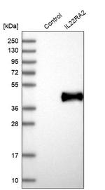 IL22RA2 Antibody in Western Blot (WB)