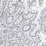 SAMD15 Antibody in Immunohistochemistry (IHC)