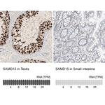 SAMD15 Antibody