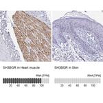 SH3BGR Antibody