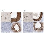 RCN2 Antibody in Immunohistochemistry (IHC)