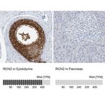 RCN2 Antibody in Immunohistochemistry (IHC)