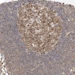 MKL1 Antibody in Immunohistochemistry (IHC)