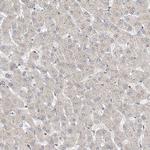 MKL1 Antibody in Immunohistochemistry (IHC)