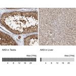 Adenylate Kinase 9 Antibody in Immunohistochemistry (IHC)