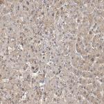 Adenylate Kinase 9 Antibody in Immunohistochemistry (IHC)