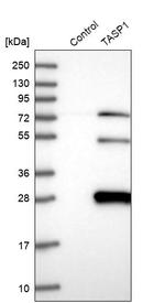 TASP1 Antibody in Western Blot (WB)