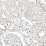 TAL2 Antibody in Immunohistochemistry (IHC)