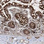 MX1 Antibody in Immunohistochemistry (IHC)