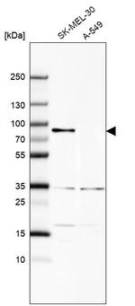 MX1 Antibody in Western Blot (WB)