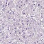 LGSN Antibody in Immunohistochemistry (IHC)