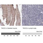 TACC2 Antibody