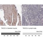 TACC2 Antibody