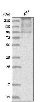 TACC2 Antibody in Western Blot (WB)