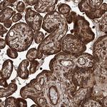 PISD Antibody in Immunohistochemistry (IHC)